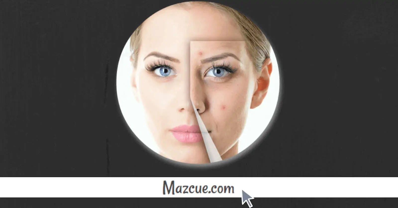 5 costumbres que debes evitar si tienes acné